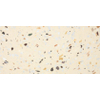 Saniclass Tops Plan de travail - 60x1.8x46cm - 1 évacuation - sans trous de robinet - Terrazzo crème SW1030692